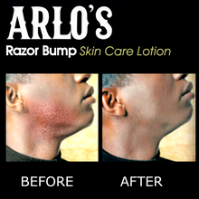 Load image into Gallery viewer, Arlo's Razor Bump Skin Care Lotion 6 oz