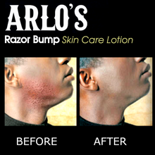 Load image into Gallery viewer, Arlo&#39;s Razor Bump Skin Care Lotion 6 oz